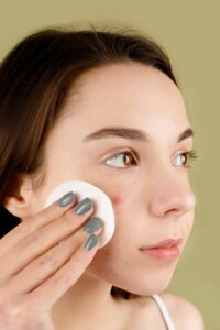 Why skin care products cause acne