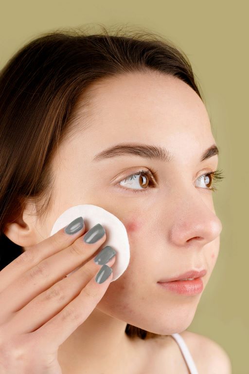 Why skin care products cause acne